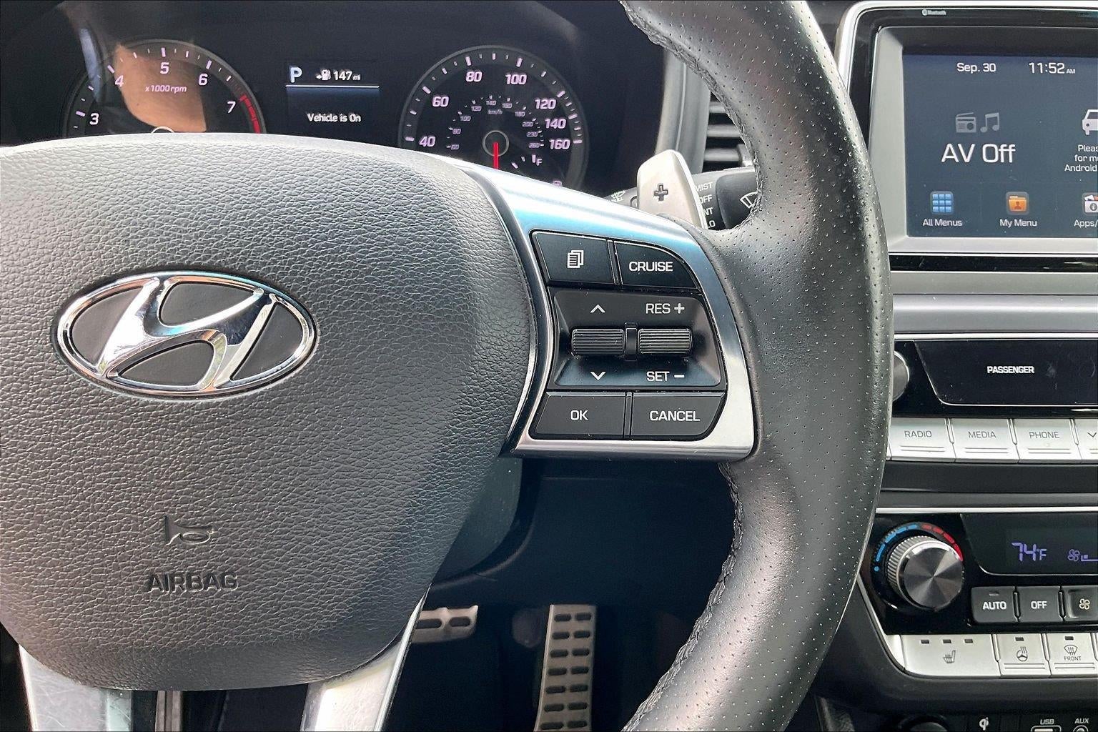 2018 Hyundai Sonata Sport+
